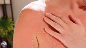 Food to Help You Recover From Sunburns
