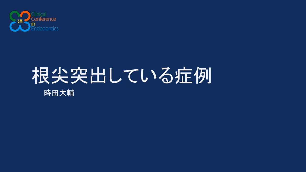 根尖突出している症例｜時田 大輔先生(Archives)