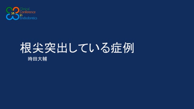 根尖突出している症例｜時田 大輔先生(Archives)