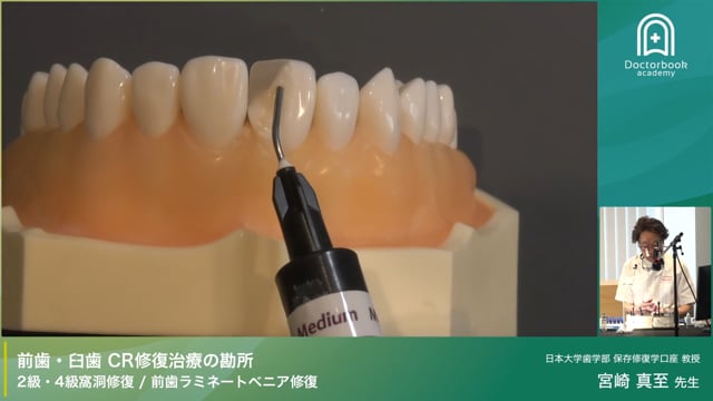 シリコンガイドで仕上げる4級修復：審美性と機能性を両立する形成テクニック