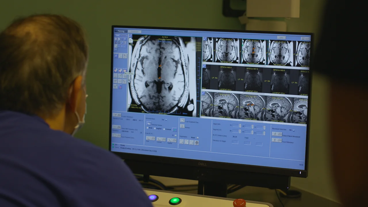 Focused Ultrasound – Los Angeles, CA | Cedars-Sinai