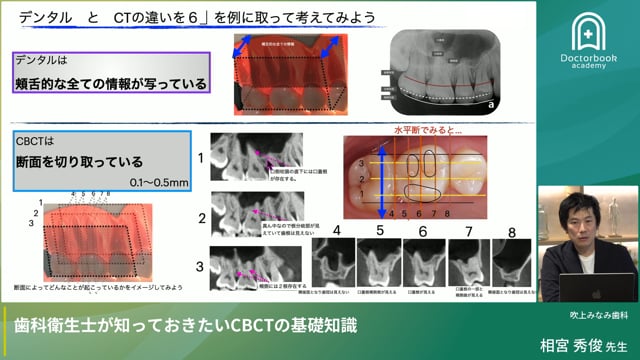 歯科衛生士が知っておきたいCBCTの基礎知識