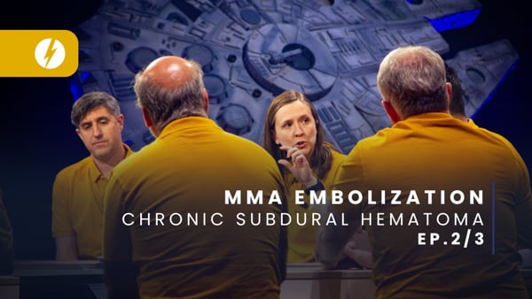 BEST OF MMA Embolization - Next Frontier of subdural hematoma treatment - Ep.2/3