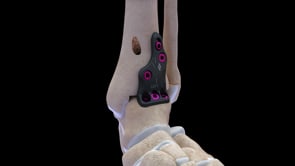 Animation Airlock Ankle
