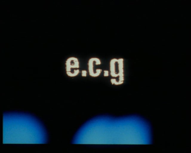 Thumbnail for e.c.g.