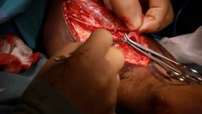 Video 8. Clipping and tying side branches.