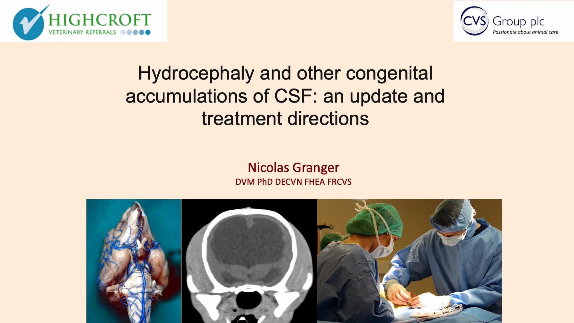 Hydrocephaly and other congenital accumulations of CSF Hydrocephaly and other congenital accumulations of CSF