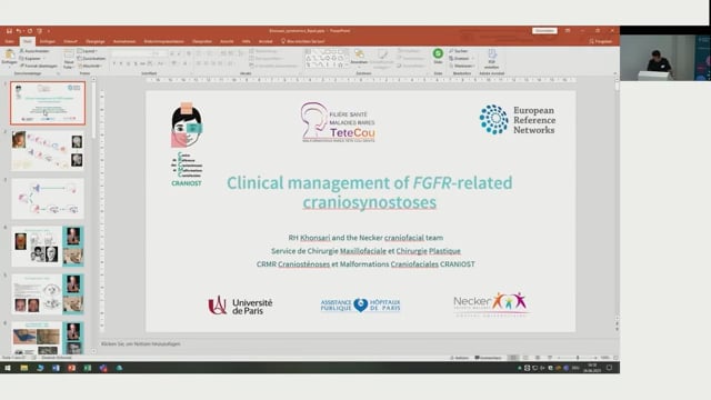 Clinical Management of FGFR- Related Craniosynostoses
