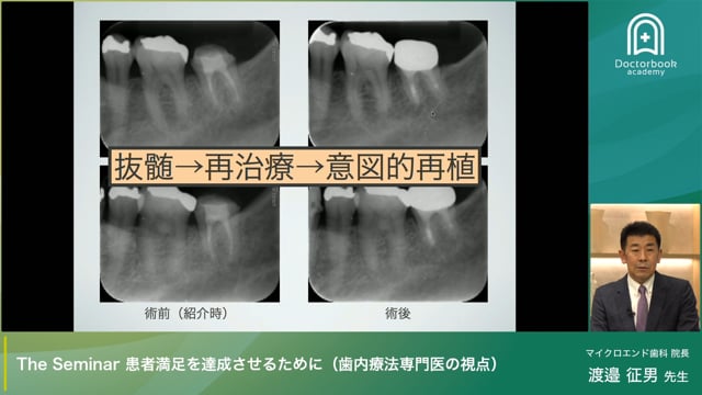 患者満足を達成させるために（歯内療法専門医の視点）