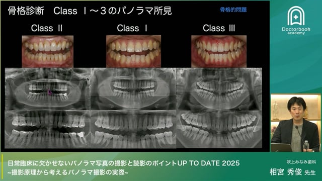 日常臨床に欠かせないパノラマ写真の撮影と読影のポイント