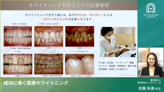 成功に導く医療ホワイトニング