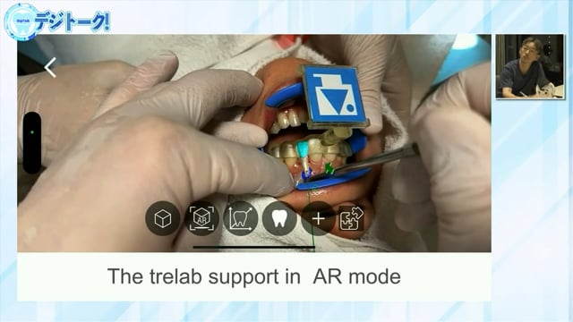 根管治療やインプラントの術中に骨や根管をリアルに確認できる最新AR技術