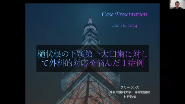 樋状根の下顎第一大臼歯に対して外科的対応を悩んだ1症例｜村野浩気先生(Topics)