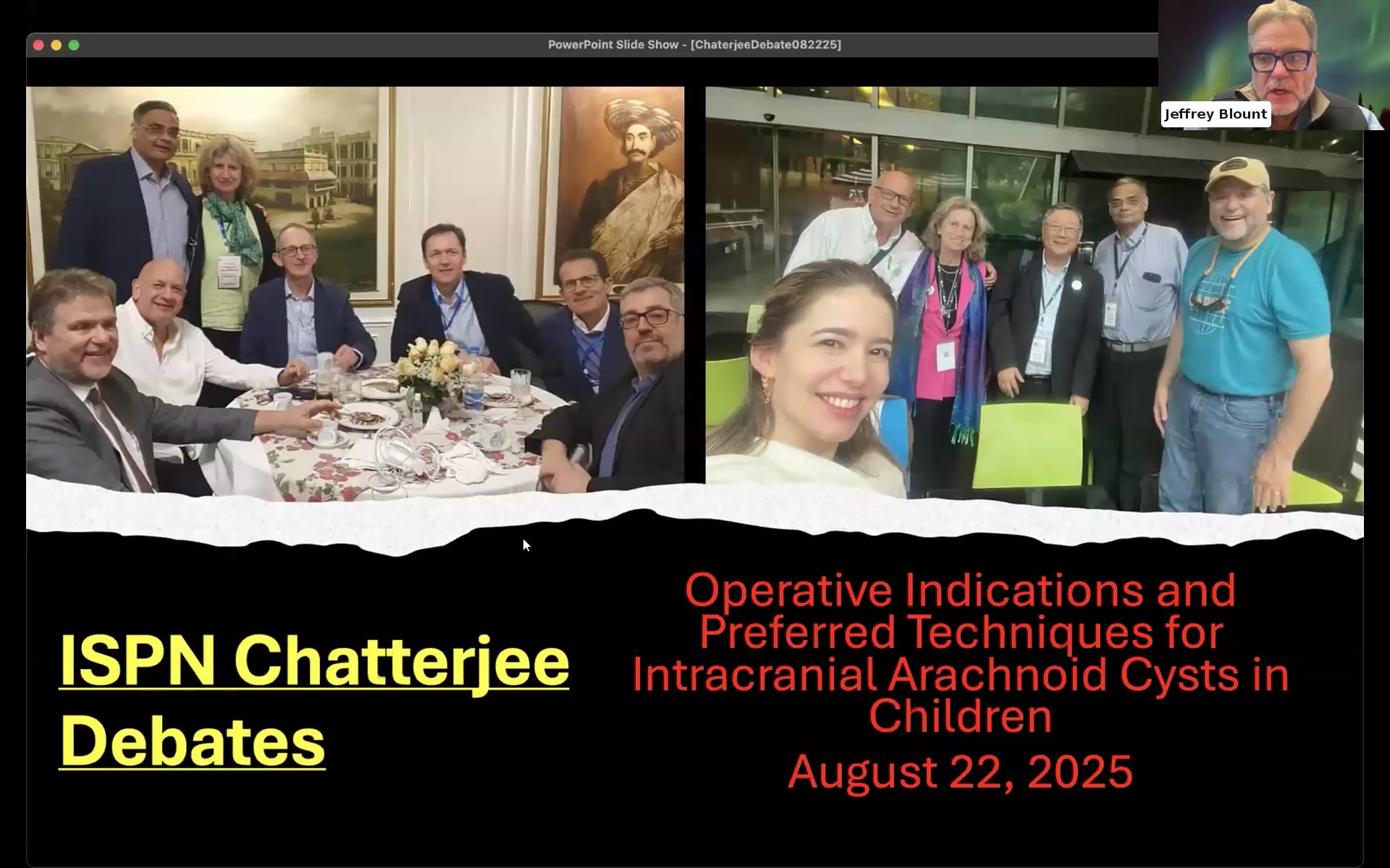 Chatterjee Controversy; Should Intra-Cerebral Arachnoid Cysts be Observed or Operatively Fenestrated?