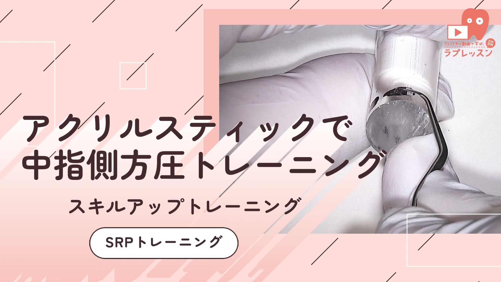 07.SRPトレーニング_-アクリルスティックで中指側方圧トレーニング