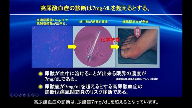 ②尿酸管理の重要性（株式会社富士薬品）