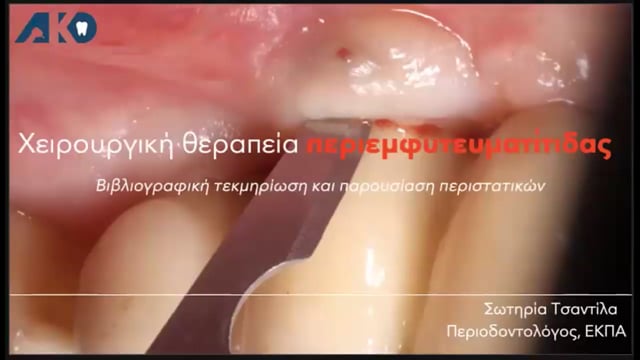 Χειρουργική θεραπεία περιεμφυτευματίτιδας. Βιβλιογραφική τεκμηρίωση & παρουσίαση περιστατικών.