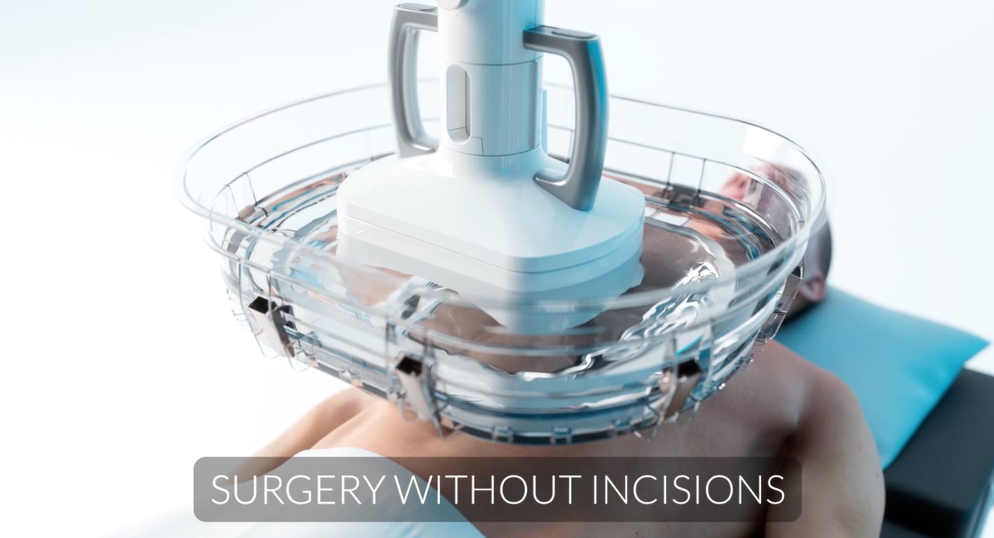 Surgery Without Incisions