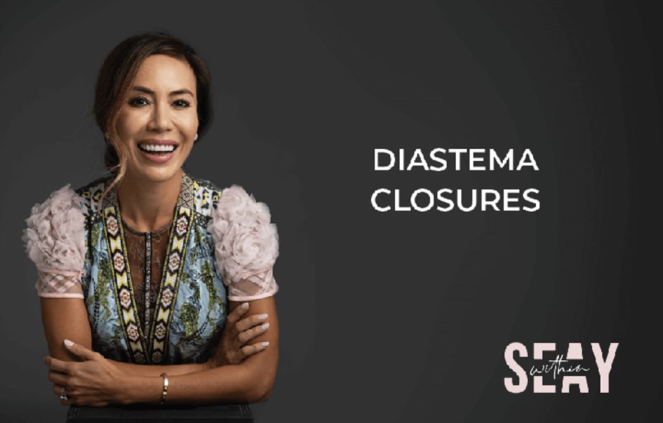 Diastema Closures:  More Than Just Closing the Gap