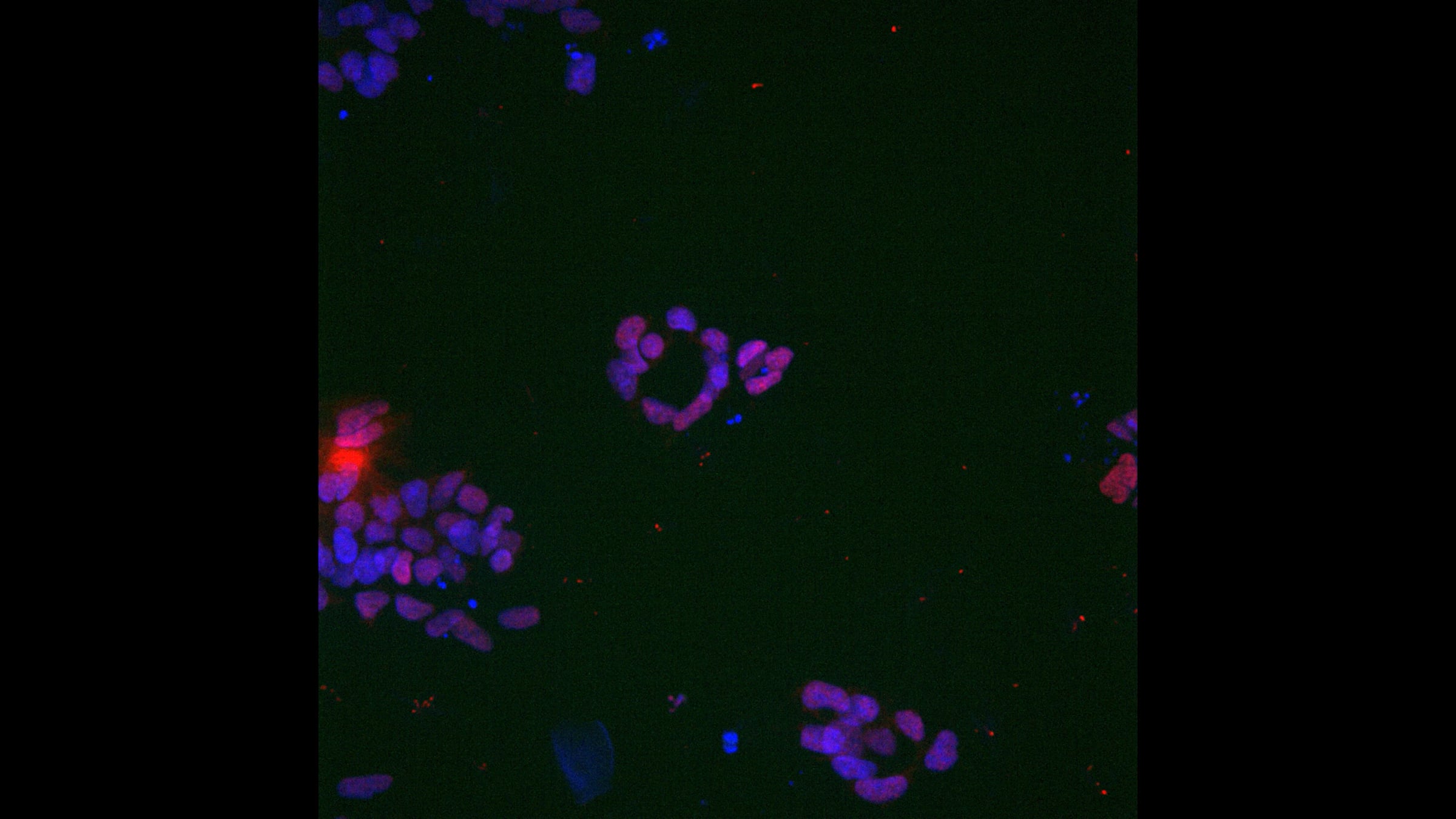In Loco Parentis: Cells | Videos & Movies on Vimeo