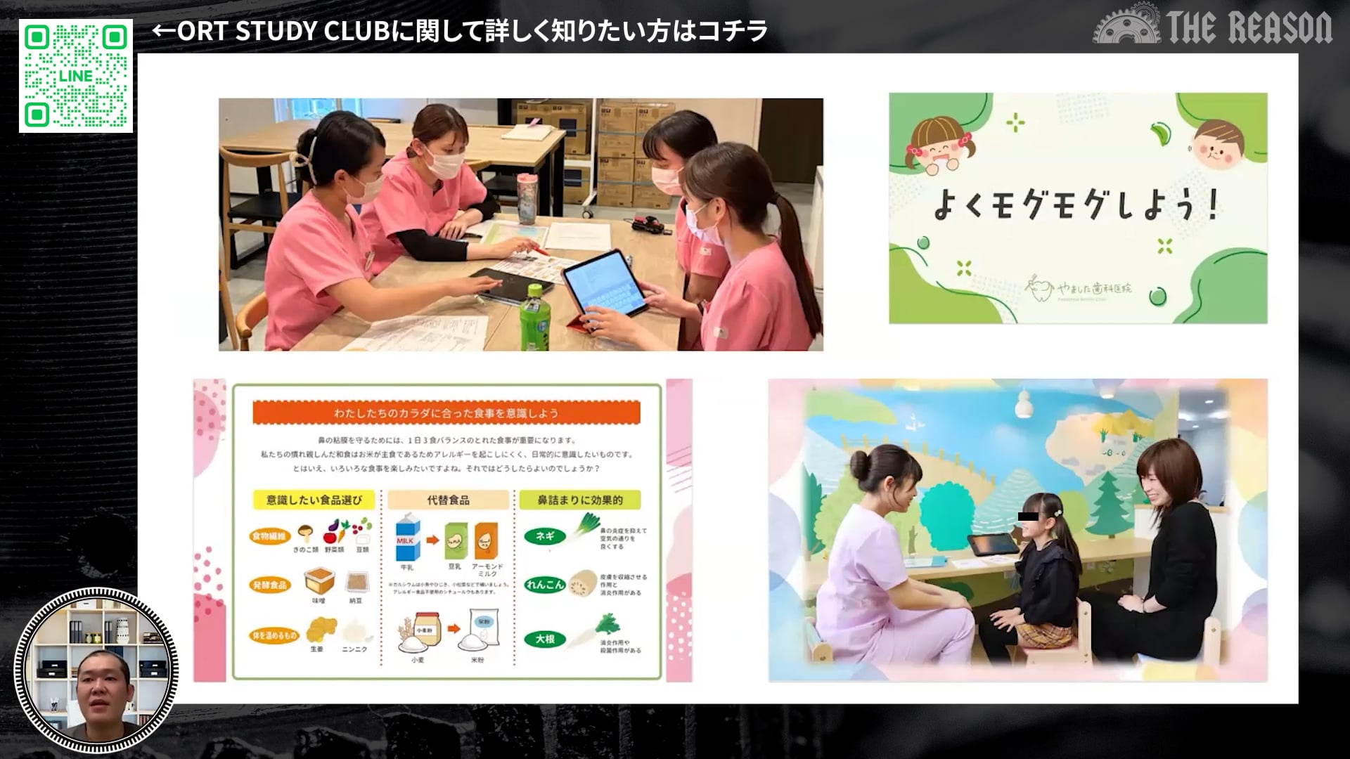 第31回 先天性疾患を有する小児の口腔機能発達支援 ― 多職種連携で挑む包括的アプローチ