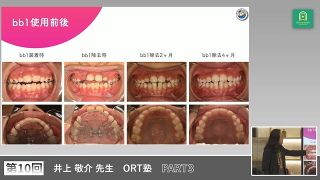ORT塾 第10回 PART3【期間限定プレミアム公開】