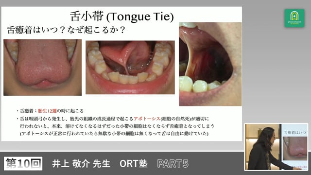 ORT塾 第10回 PART5【期間限定プレミアム公開】