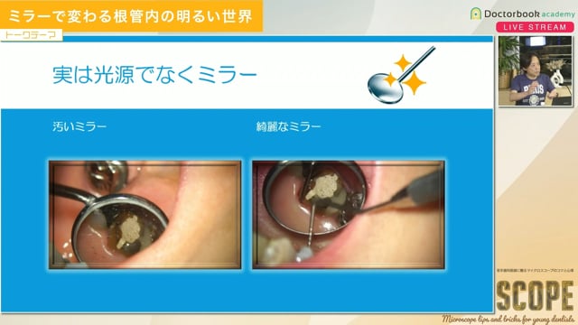 ミラーで変わる根管内の明るい世界