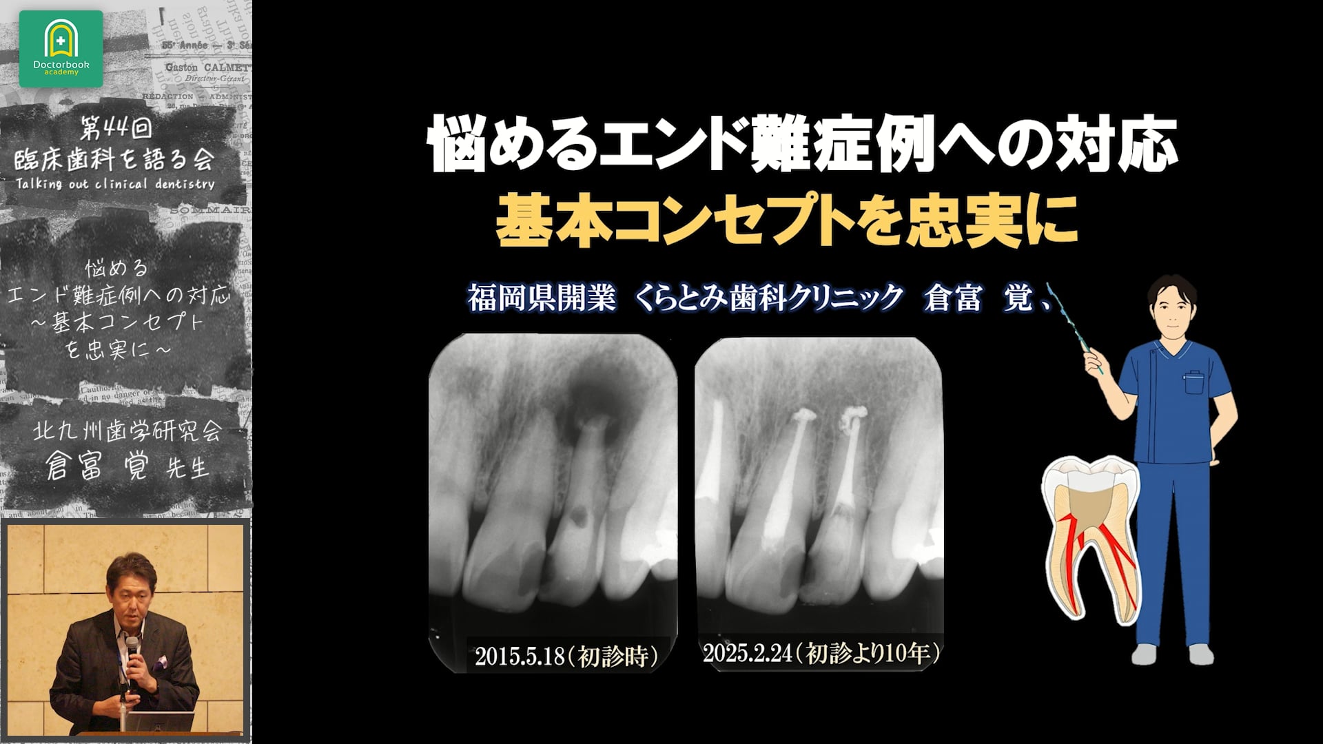 悩めるエンド難症例への対応 基本コンセプトを忠実に：倉富 覚先生｜全体会