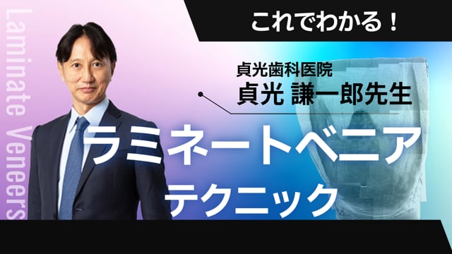 これでわかる！ ラミネートベニアテクニック