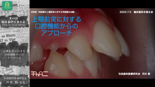 上顎前突に対する口腔機能からのアプローチ：河井 聡先生｜ 分科会 「成長期の上顎前突に対する早期矯正治療 」