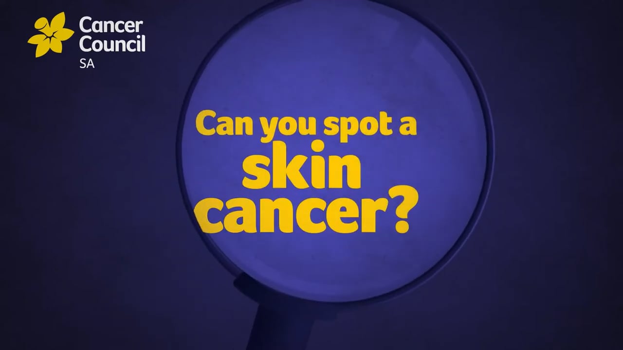 Can you spot a skin cancer?