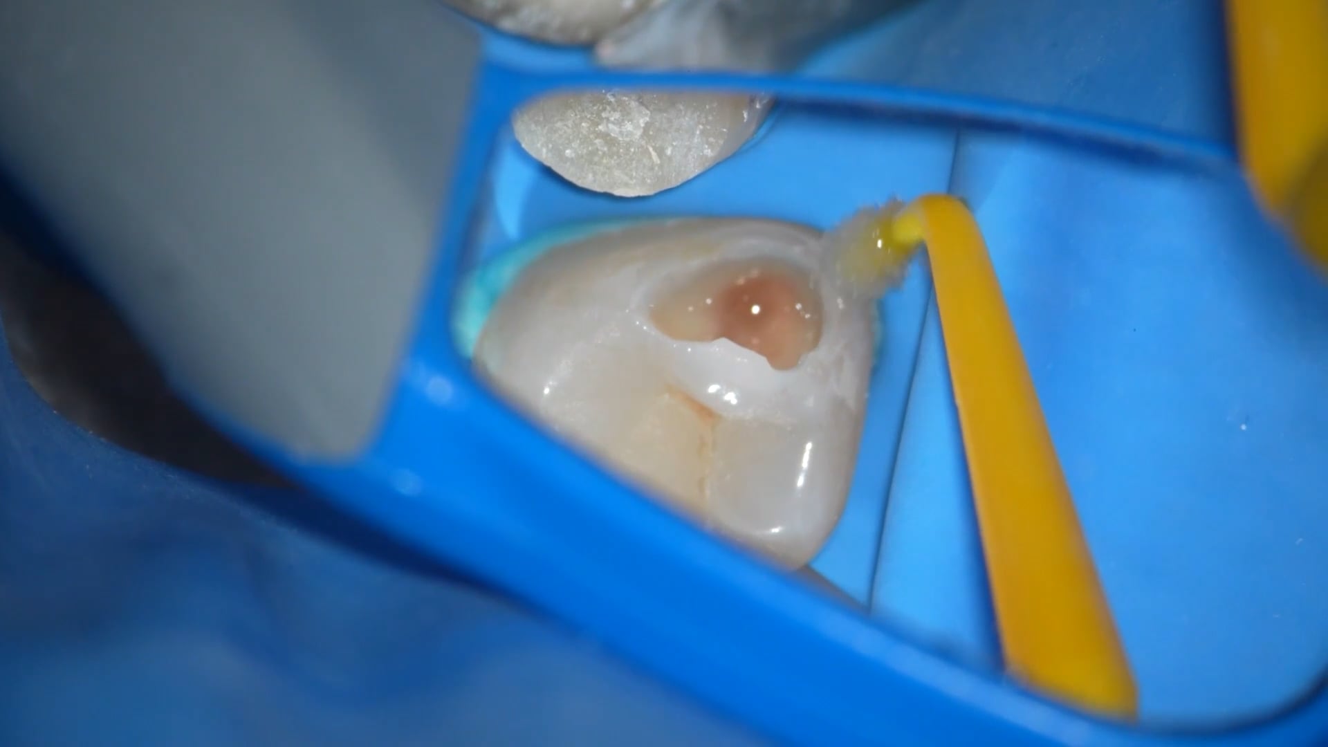 【GPB_direct-bonding_llp_030】前処理