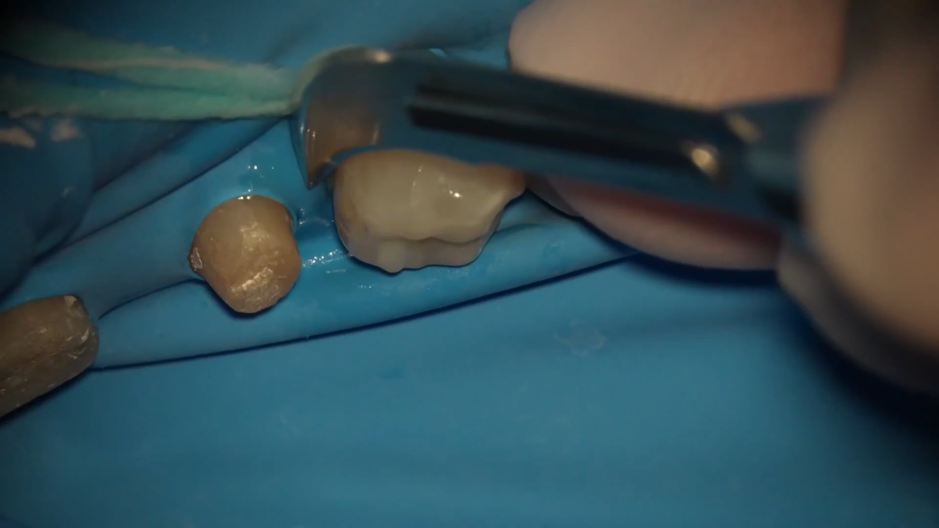 【GPB_direct-bonding_llp_050】研磨