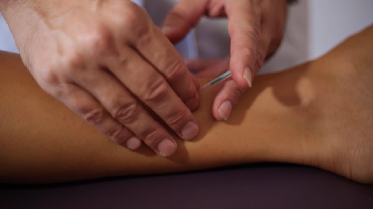 acunpultura largo_clean