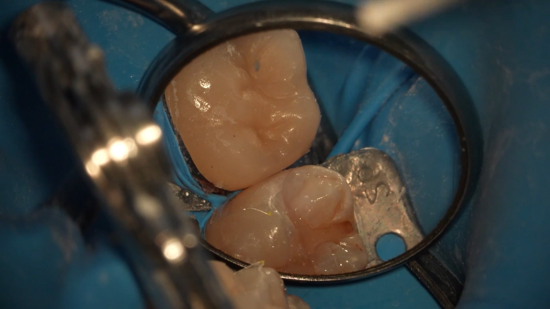 【GPB_direct-bonding_rup_050】研磨