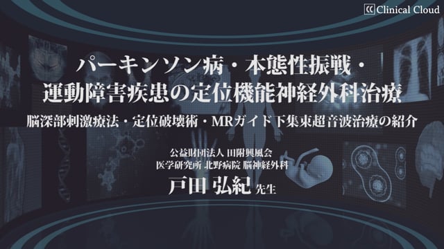 パーキンソン病・本態性振戦・運動障害疾患の定位機能神経外科治療
