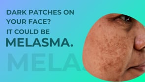 MELASMA DR SIMONE