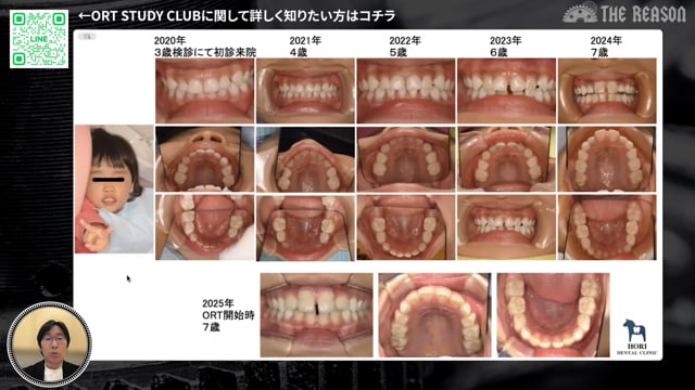 第32回 小児口腔機能発達支援と多職種連携による地域での取り組み