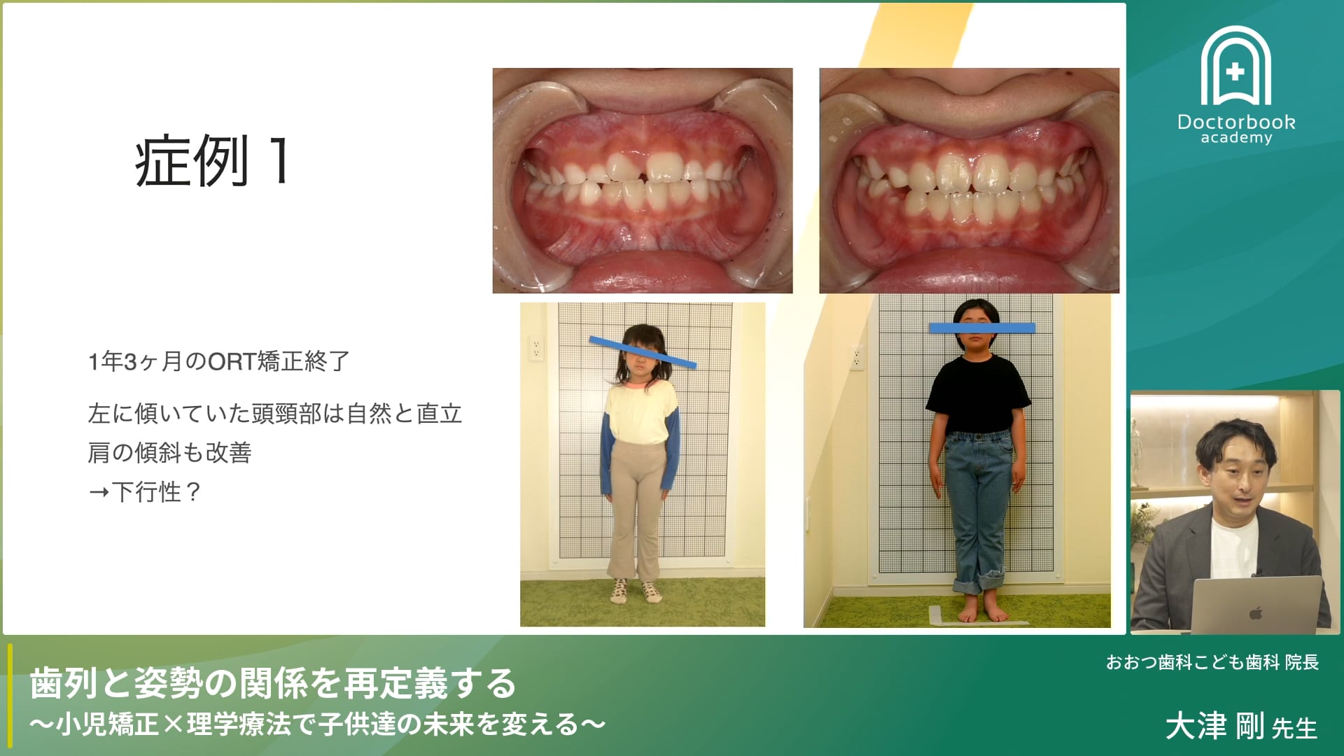 歯列と姿勢の関係を再定義する〜小児矯正×理学療法で子供達の未来を変える〜