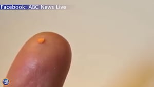 New Implant Could Cure Blindness