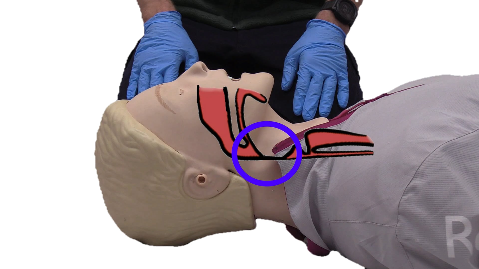 CPR - Opening the Airway
