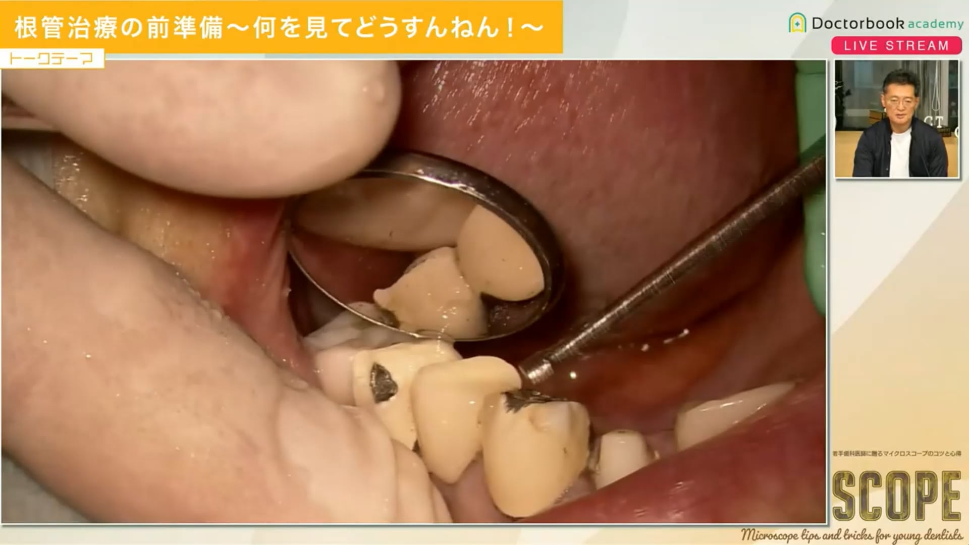 ココが重要！根管治療の前準備〜何を見てどうすんねん！〜