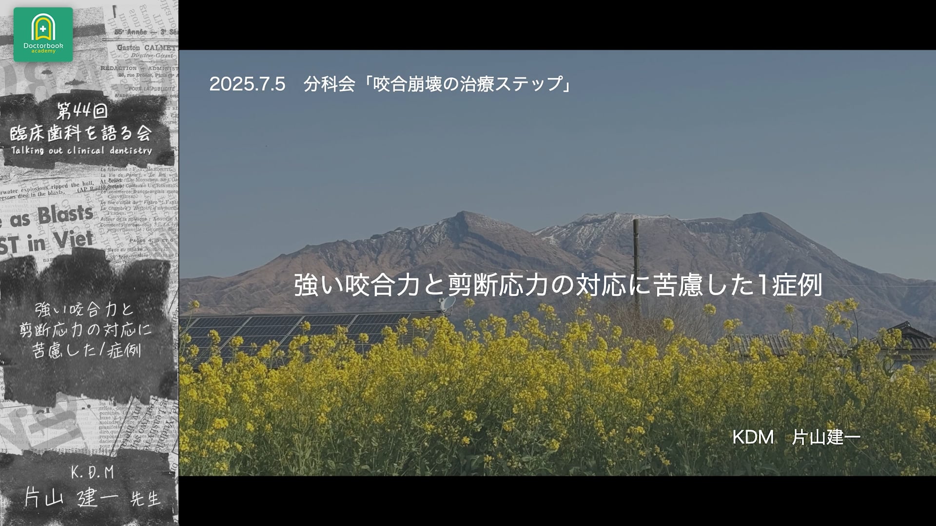 強い咬合力と剪断応力の対応に苦慮した1症例：⽚⼭ 建一先生｜分科会「咬合崩壊症例の治療ステップ ~治療用義歯をどう活用するか~」