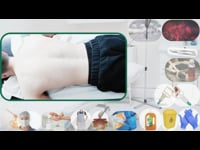 Sunnah Hijama Cupping Therapy for Upper Back (Part 1)