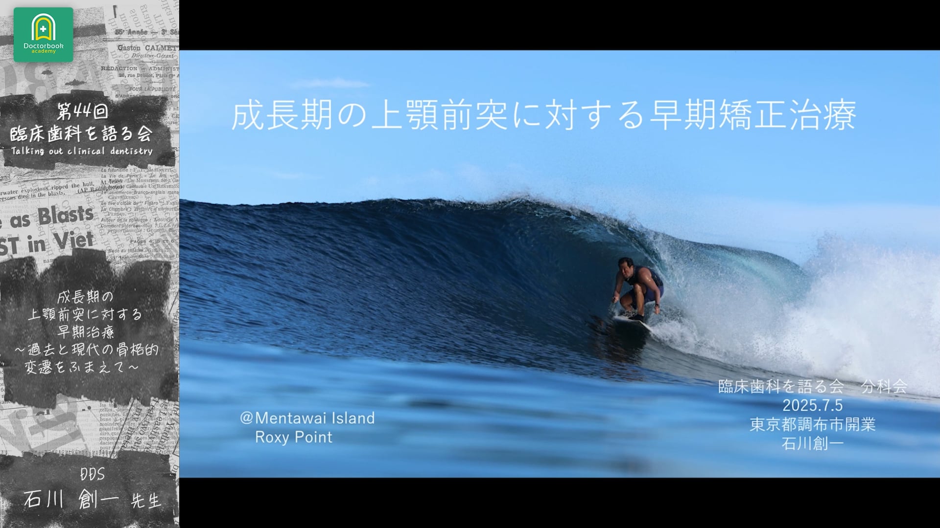 成長期の上顎前突に対する早期矯正治療：石川 創一先生｜ 分科会 「成長期の上顎前突に対する早期矯正治療 」