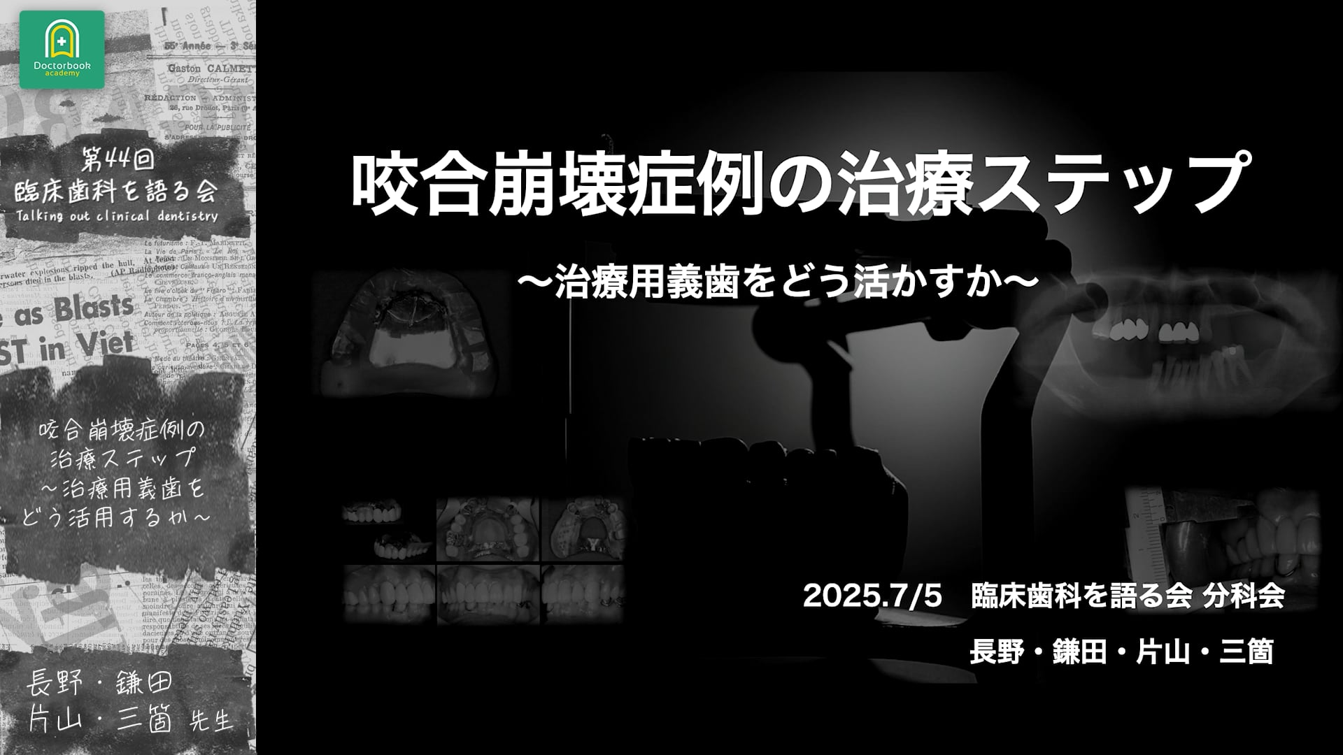 Introduction｜分科会「咬合崩壊症例の治療ステップ ~治療用義歯をどう活用するか~」