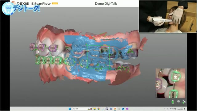 DEXIS IOSから広がるエンビスタデジタルソリューション