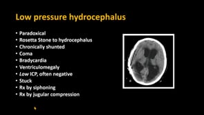 A Model of Low-Pressure as Windkessel Impairment Due to Low Brain Elastance-Michael Egnor