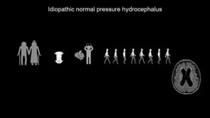 CSF lipid profiles differ between iNPH patients and healthy controls-Trine L. Toft-Bertelsen